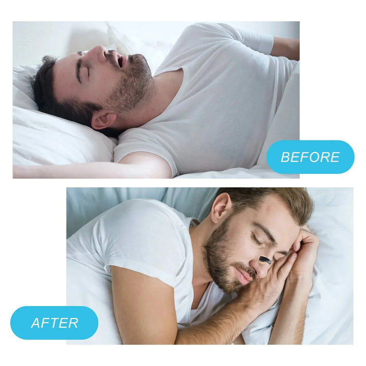 Perfect Sleep: The Anti-Snoring Solution ✅